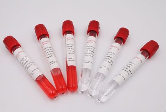 Résistance ultra à haute impression médicale de tubes de spécimen de sang d'ABS