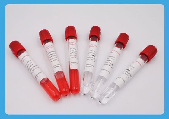 oxyde d'éthylène spécial de tube de collection témoin du fil 5ml